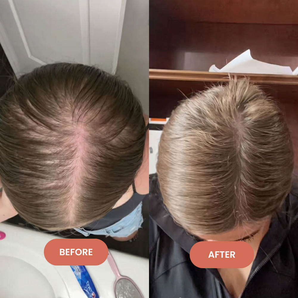 <p>Their Hair. Their Experience. Their Story.<br/></p>