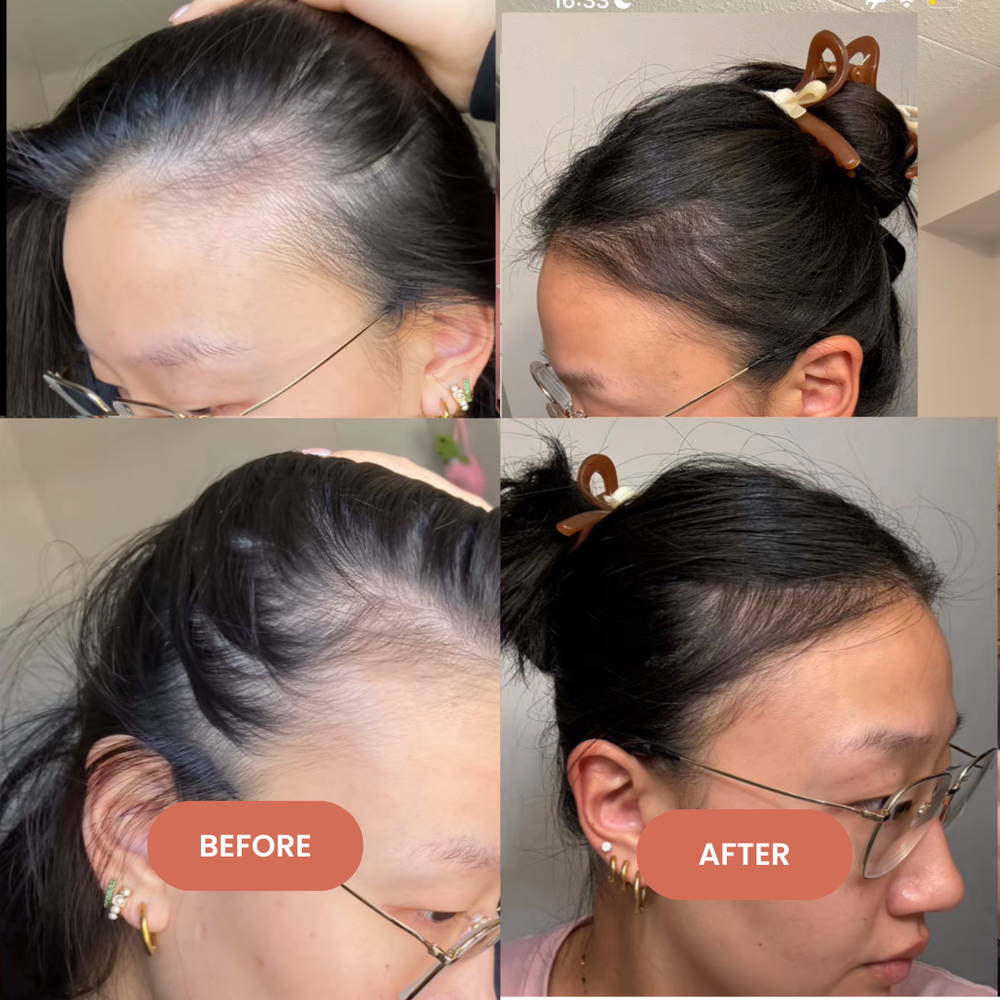 <p>Their Hair. Their Experience. Their Story.<br/></p>