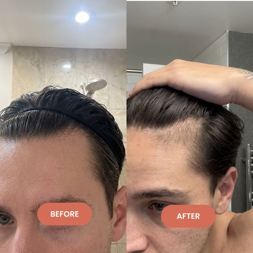 <p>Their Hair. Their Experience. Their Story.<br/></p>