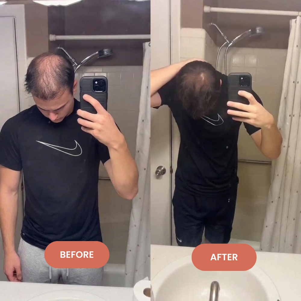 <p>Their Hair. Their Experience. Their Story.<br/></p>