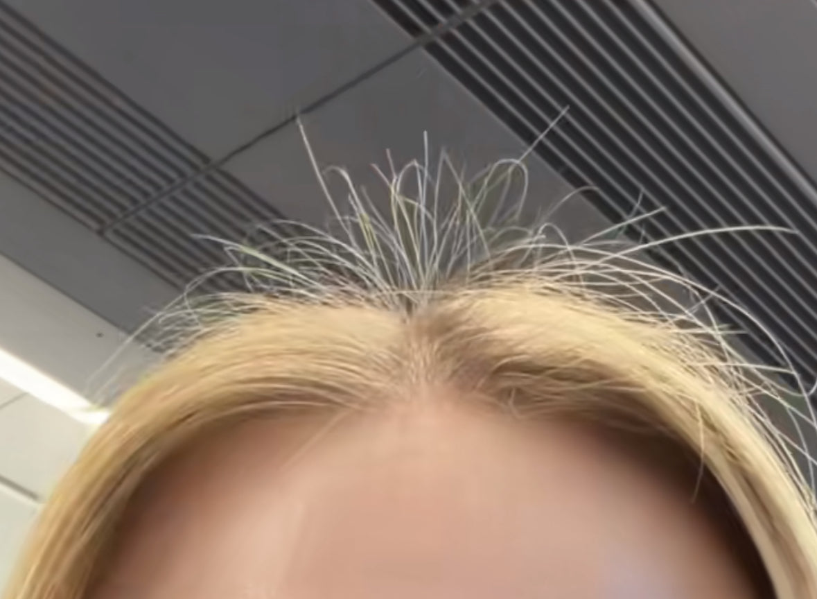 Baby Hairs & Initial Regrowth